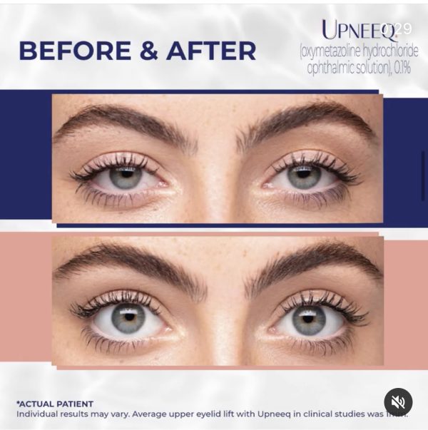 UPNEEQ KIT (45 Pack) - Image 2